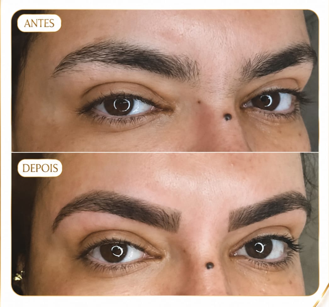 Sobrancelha Caso 2